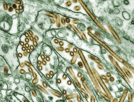 Lactobacillus casei